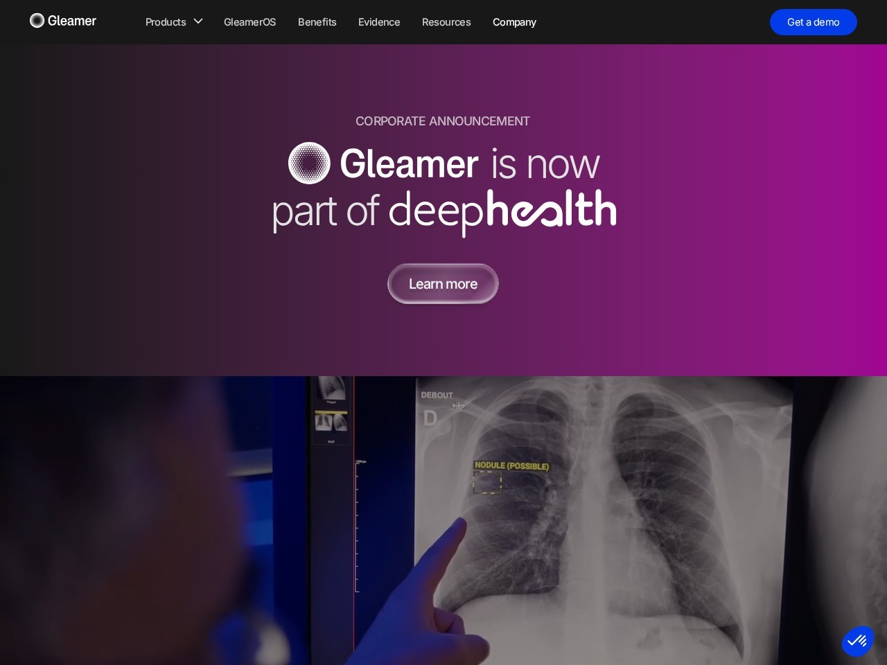 Gleamer.ai官网 – 用于放射学的医疗级人工智能